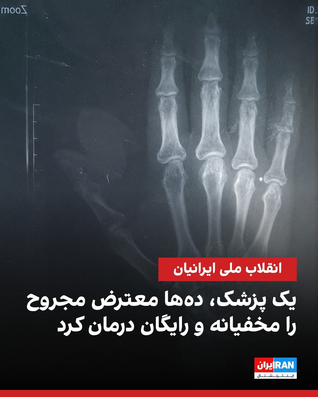 
یک منبع آگاه به ایراناینترنشنال گفت در جریان اعتراضات دی، یک زن پزشک را در تهران پیدا کرده بودند که معترضان مجروح ...